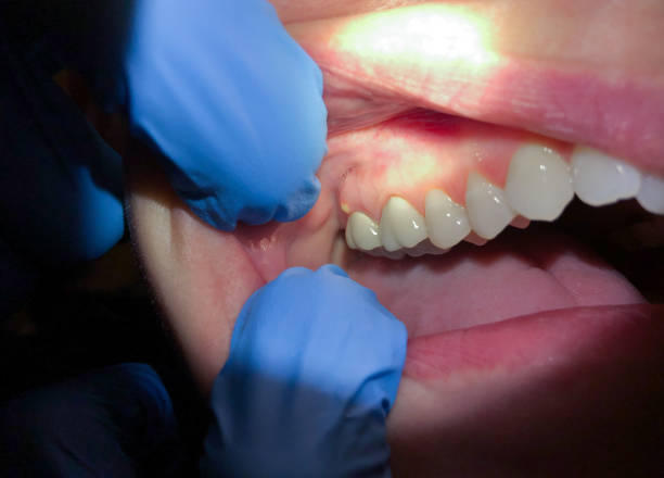 Best Emergency Dental Care for Trauma or Injury in Macon, MS