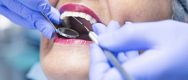 Best Emergency Treatment for Toothache in Macon, MS